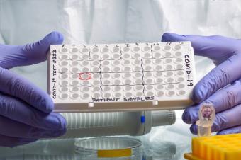 35 فحص PCR في عقتنيت وجنجلايا