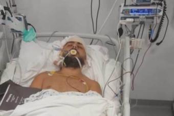 رصاصةٌ طائشة تضعُ عطوي بين الحياة والموت