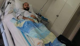 جراحة ثانية لعقيقي